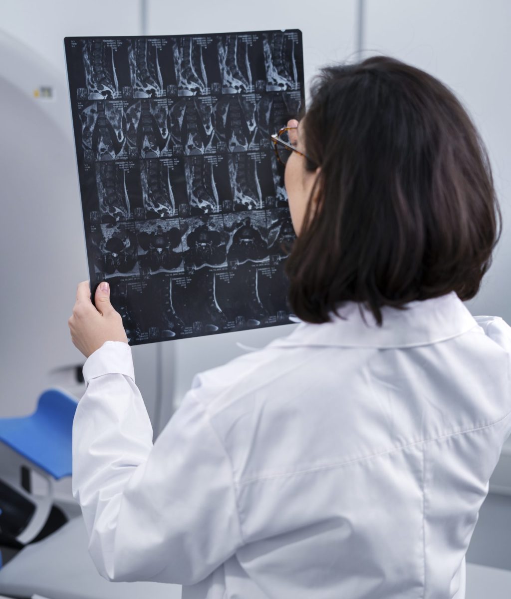 doctor-looking-ct-scan